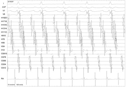 fluoroscopy 3