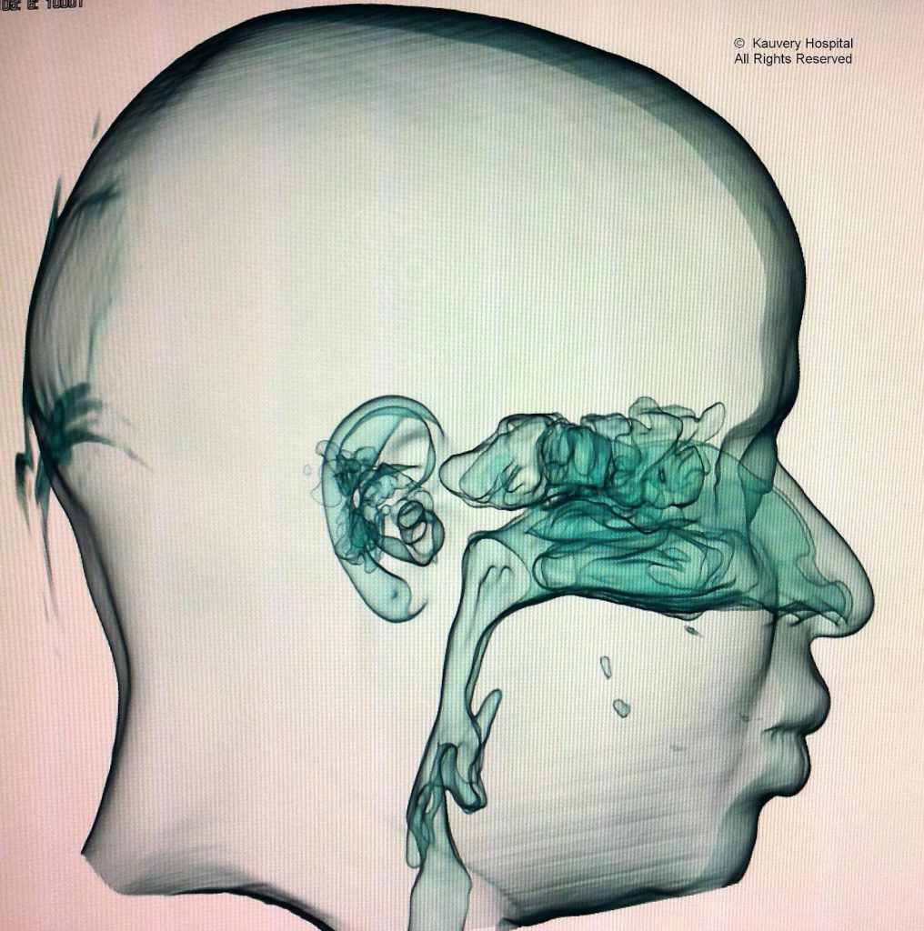 Upper Respiratory Tract