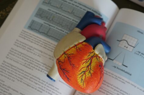Know About Cardiac Arrhythmia – Irregular Heartbeat