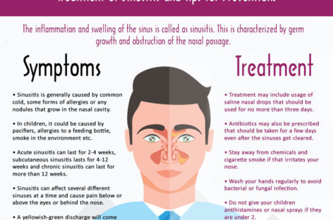Is Your Sinus Bothering You? Treatment of Sinusitis and Tips for Prevention. – Infographic