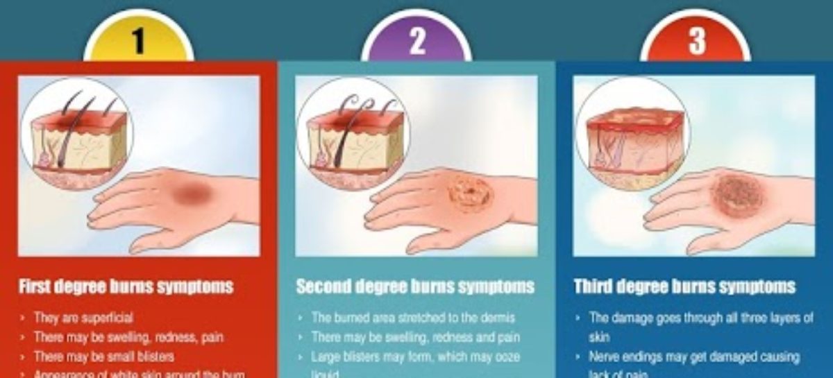 Fire Accident – Emergency Procedures – Infographic