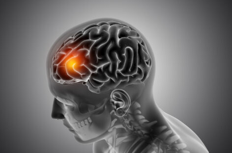 Understanding Meningitis: Causes, Symptoms, Treatment & Prevention