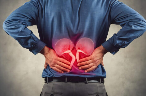 Kidney Stone Causes, Symptoms and Treatments