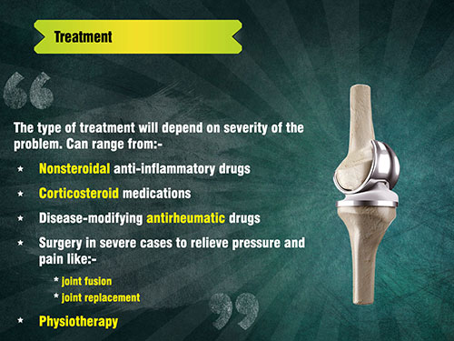 Treatment for Rheumatoid Arthritis