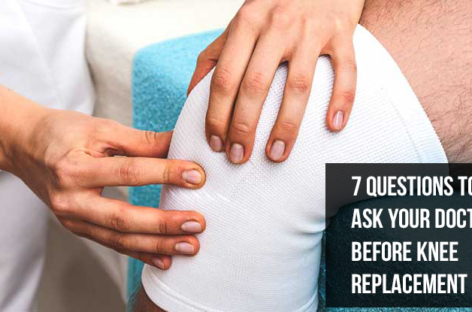 7 Questions To Ask Your Doctor Before Knee Replacement