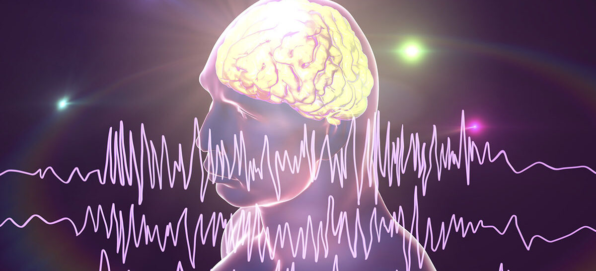 What are the kinds of Epileptic Fits?