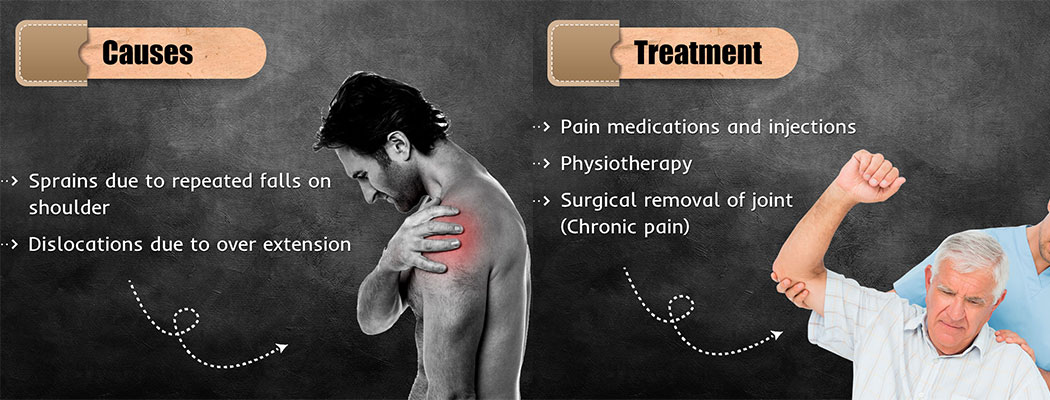 ACJ Injuries - Causes and Treatment 
