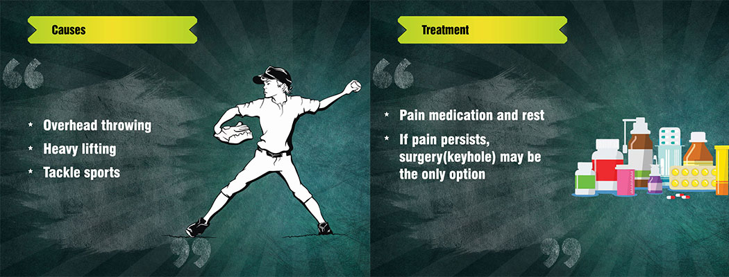 SLAP Lesions - Causes and Treatment 