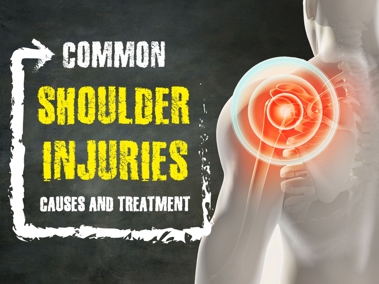 common shoulder injuries