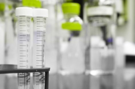 What does your lipid profile tell about your heart health?