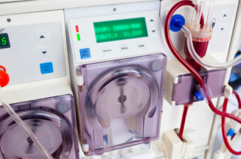What is the procedure for dialysis?