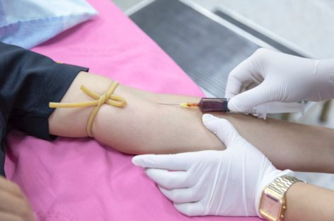 The Importance of Thyroid Blood Tests