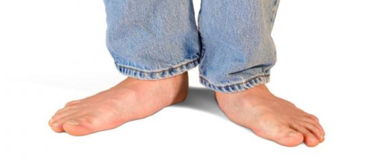 What is Flat Foot and how can it be treated?