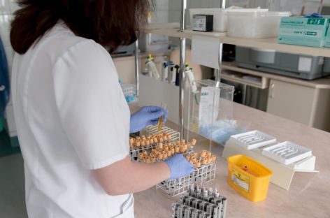What is a Cardiac Enzyme Test? Why should it be taken?And what do the results mean?