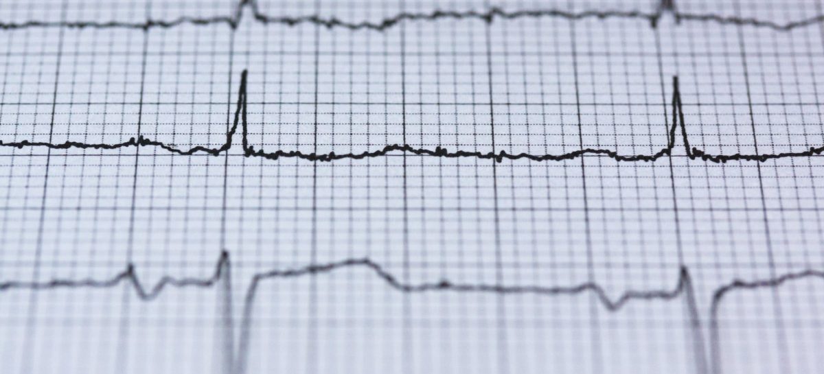 Is it Heartburn or a Heart attack?