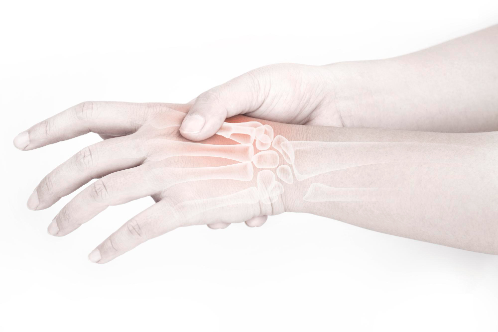 Higher Risk of Bone Loss