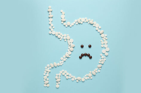 Does Stress cause ulcers?