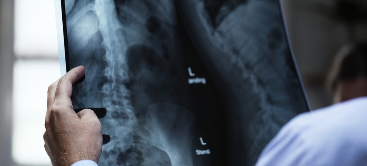 Factors that affect Bone Health