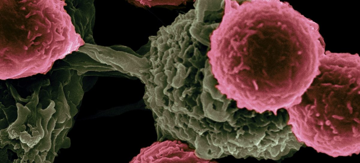 Breast Cancer Early Detection: Myths vs. Facts About Self-Exams and Mammograms
