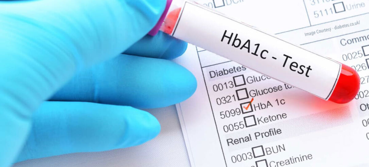 FAQs on HBA1C Test
