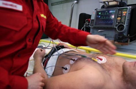 Atrial Fibrillation And Embolic Strokes