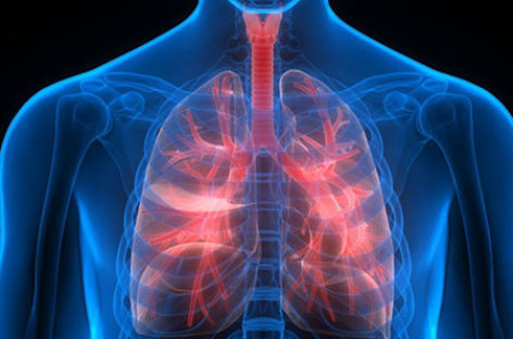 Complications arising out of Respiratory Disease