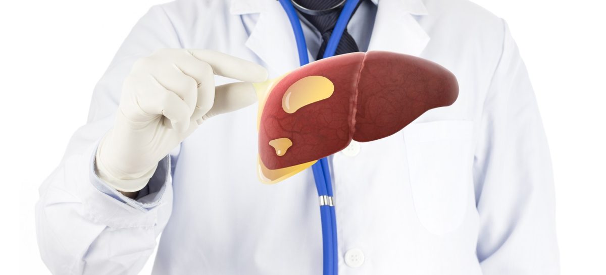 What is Fatty Liver Disease?