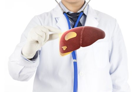 What is Fatty Liver Disease?