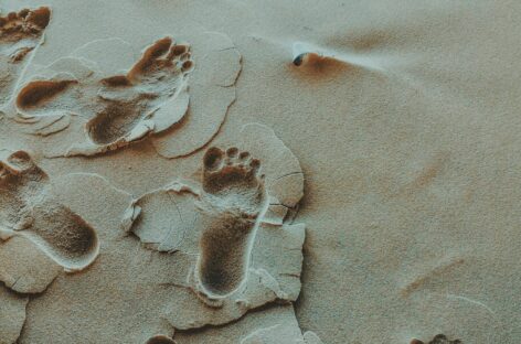Diabetic Foot Ulcers – If you are diabetic, do not ignore foot ulcers