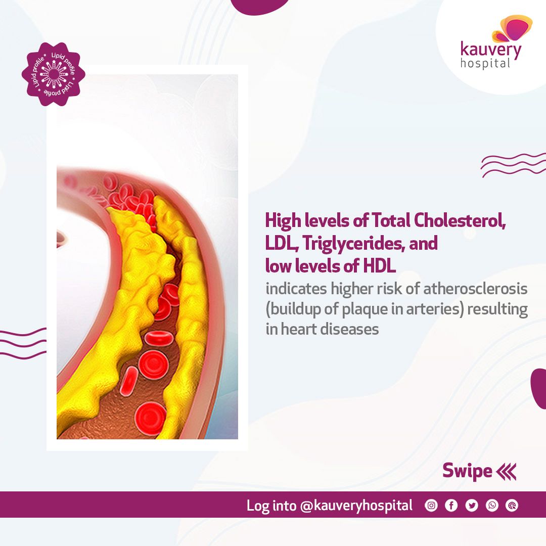 HDL VS LDL