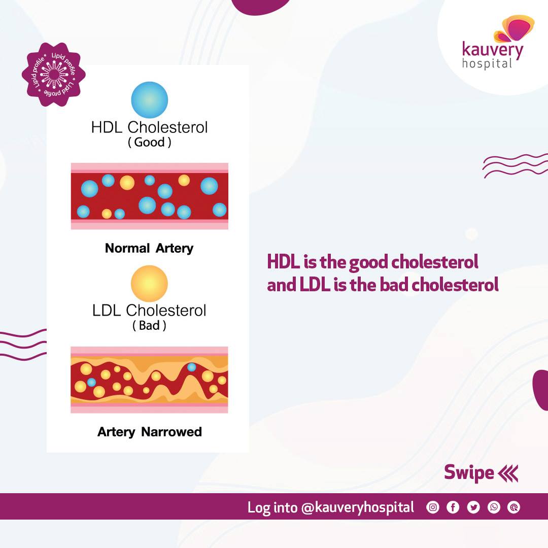 HDL and LDL