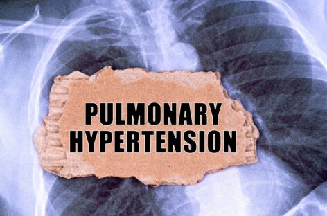Pulmonary Hypertension – Symptoms and Treatment