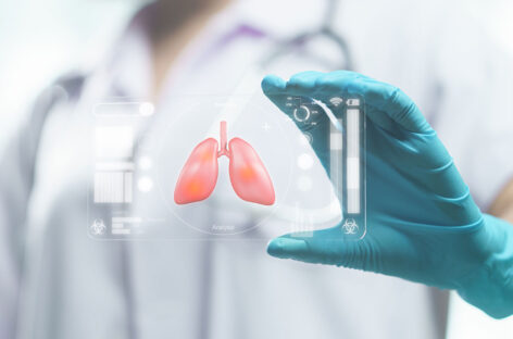 What Happens Before a Lung Transplantation?
