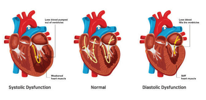 Kauvery Heart & Lung Transplant Centre