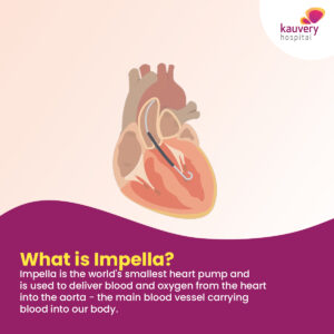 Impella Heart Pump