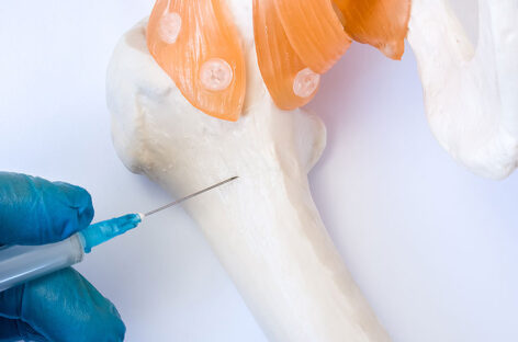 What is the function of bone marrow? How are bone marrow tests done?