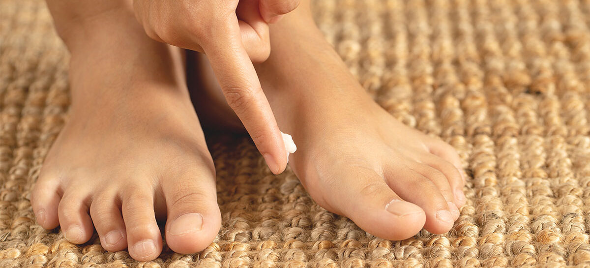 Fungal Infection – Types and Treatment