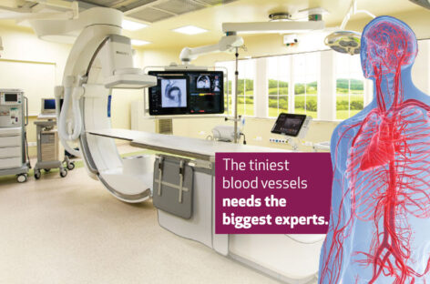 The Tiniest Blood Vessels Needs the Biggest Experts