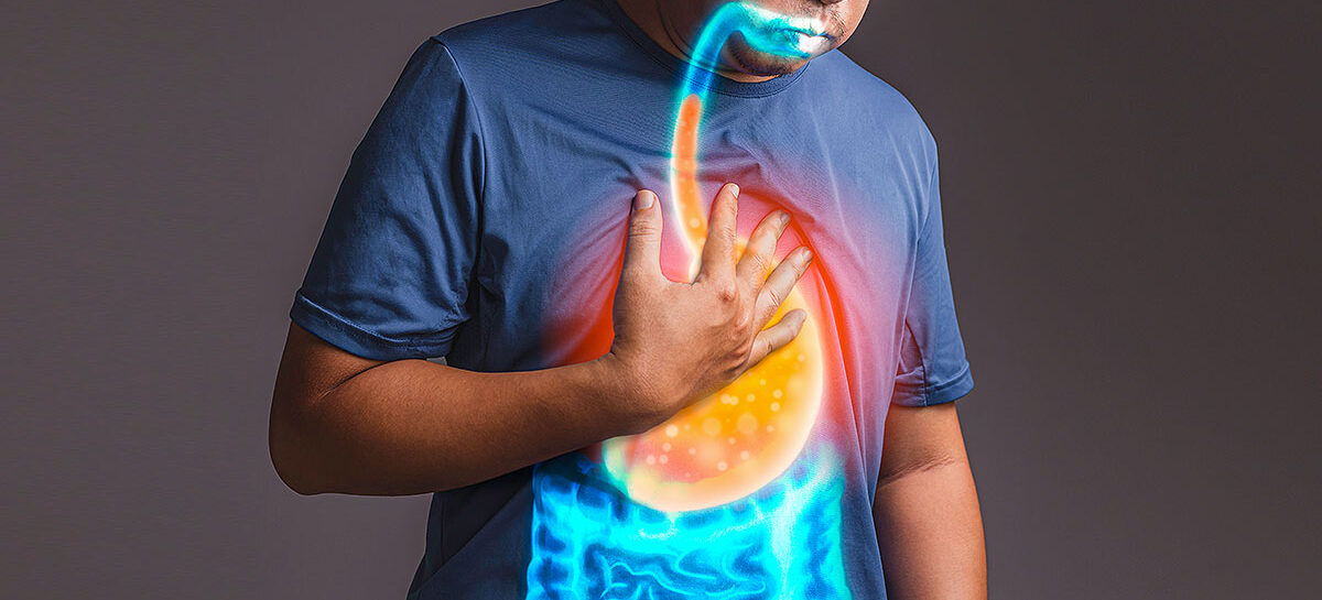 Medications and Diet Plan for Treatment of GERD
