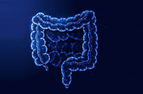 What is Rectal Cancer? Symptoms and Treatment for Rectal Cancer