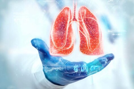 Lung Biopsy- Procedure and Recovery