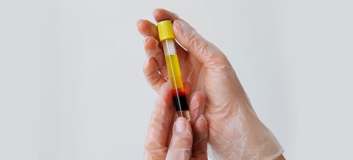 Plasma – Basic facts and donation