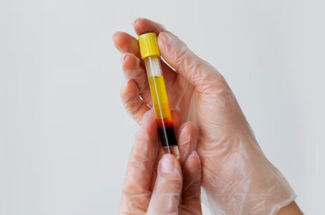 Plasma – Basic facts and donation