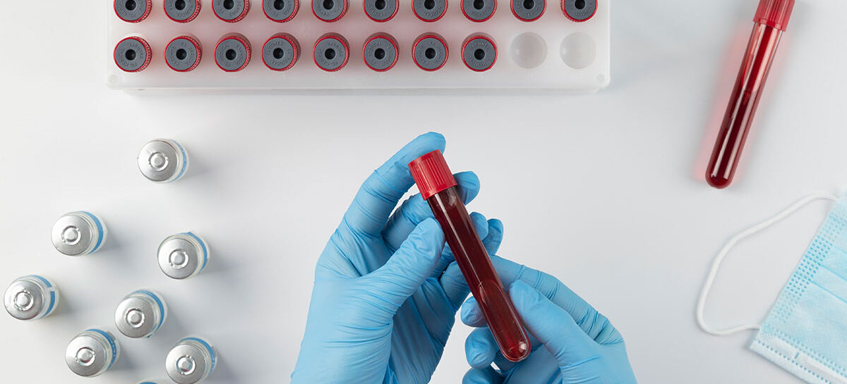 Understanding and Managing Electrolyte Imbalances