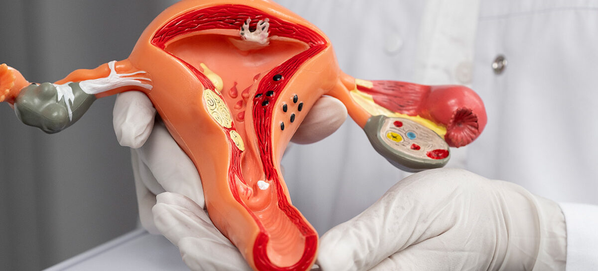 Hysteroscopy procedure for Gynaecologic Conditions