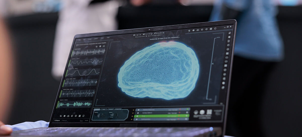 Deep Brain Simulations for the treatment of Parkinsons Disease