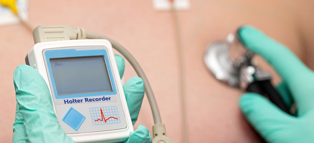 Holter Monitors – Heart Monitoring for continuous insights