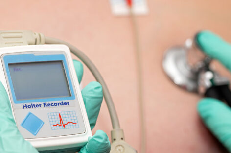 Holter Monitors – Heart Monitoring for continuous insights