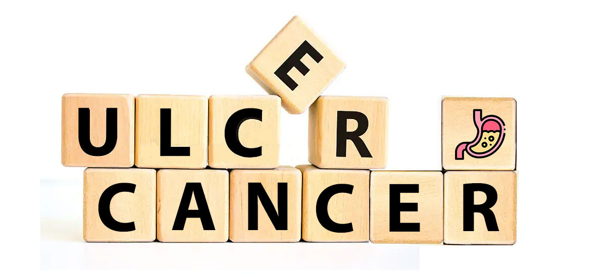 Stomach Pain – Cancer or Ulcer?