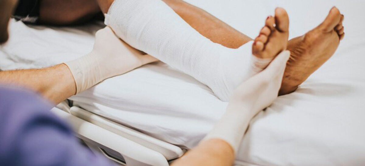Fracture Cast Care